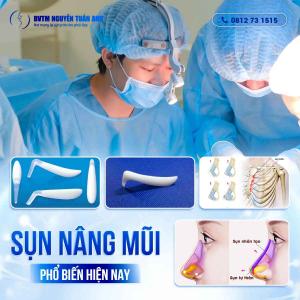 Những loại sụn nâng mũi phổ biến hiện nay