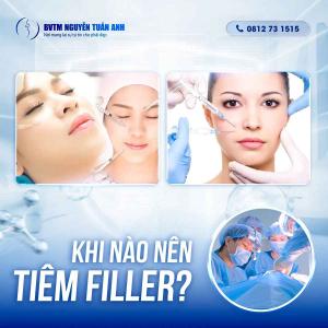 Khi nào nên tiêm filler? Và có an toàn không?