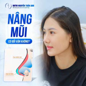 Nâng mũi phong thuỷ có thật sự đổi vận không?