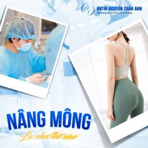 Quy trình nâng vòng 3 tại BVTM Nguyễn Tuấn Anh